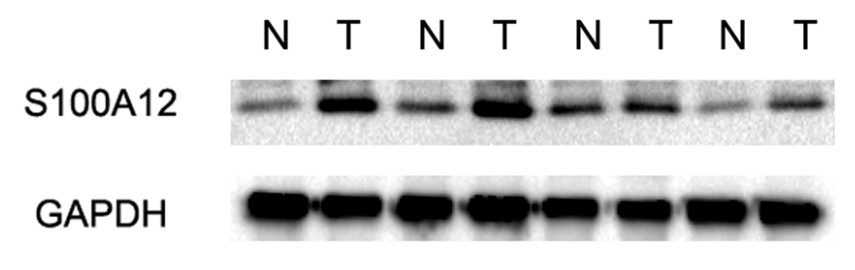 Western blotting of S100A12 expression.jpg